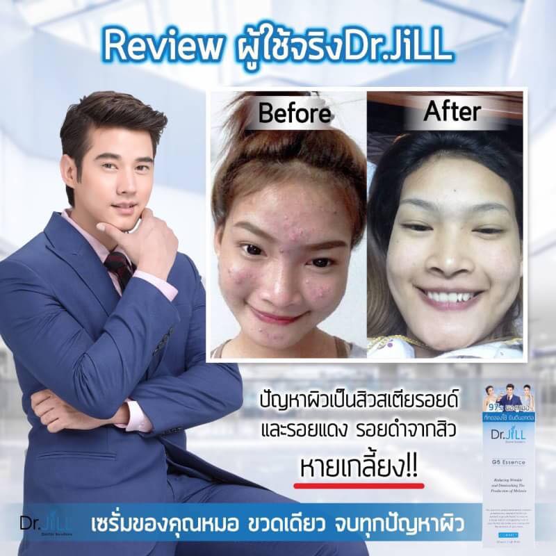 Dr.Jill Plus G5 ESSENCE, Whitening Anti Aging Moisturizing and Reducing  Wrinkle Milk Serum 30 Ml - Thai Skin Care – the best products in the Joom  Geek online store