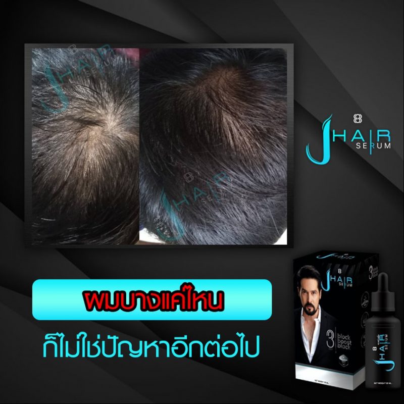 J Hair Serum - Hair Loss Serum - Thailand Best Selling ...