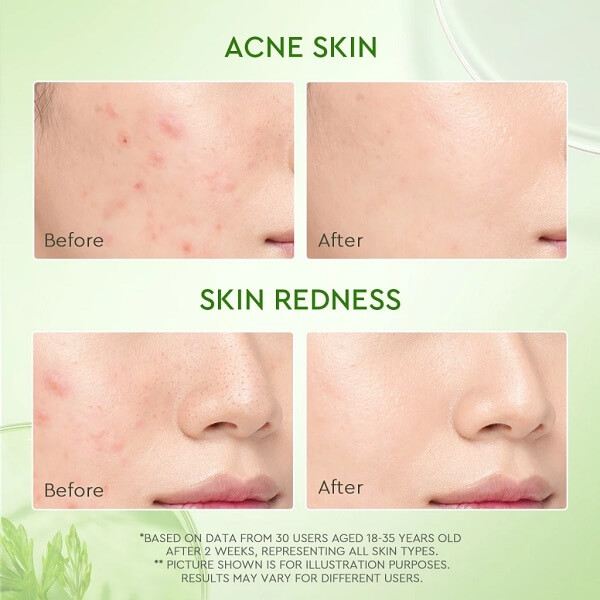 Glad2Glow Mugwort Salicylic Acid Acne Clay Stick - Image 5