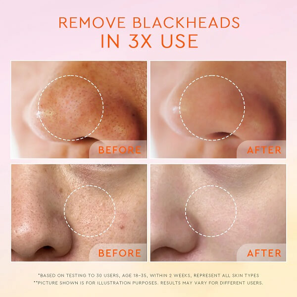 Glad2Glow Yuzu Aha Blackhead Exfoliating Cleanser - Image 11