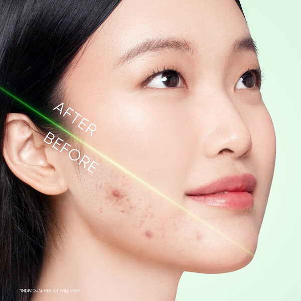 Skintific 3X Acid Acne Gel Cleanser - Image 12