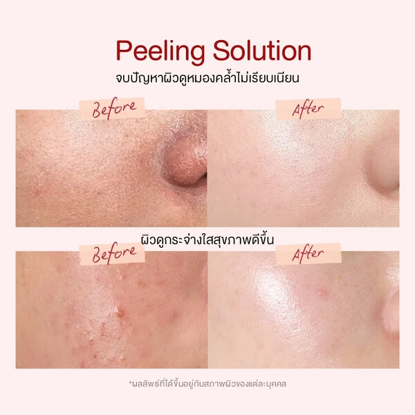 Glad2Glow AHA BHA PHA Intensive Peeling Solution - Image 10