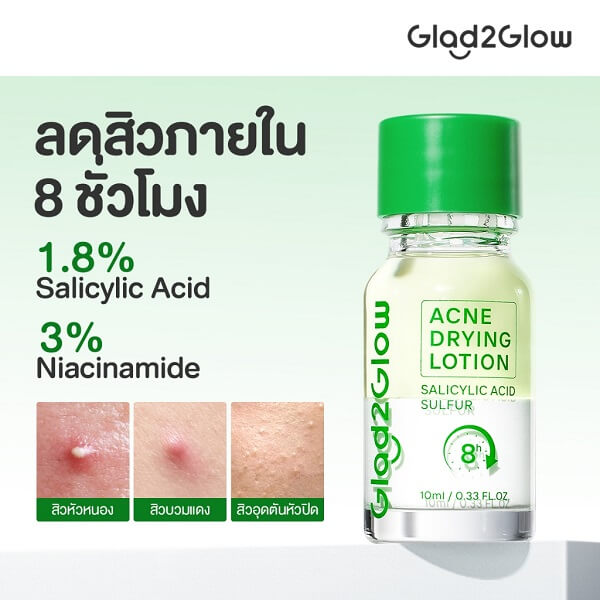 Glad2Glow Acne Drying Lotion