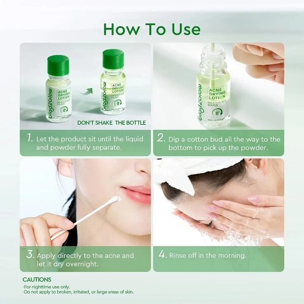 Glad2Glow Acne Drying Lotion - Image 9